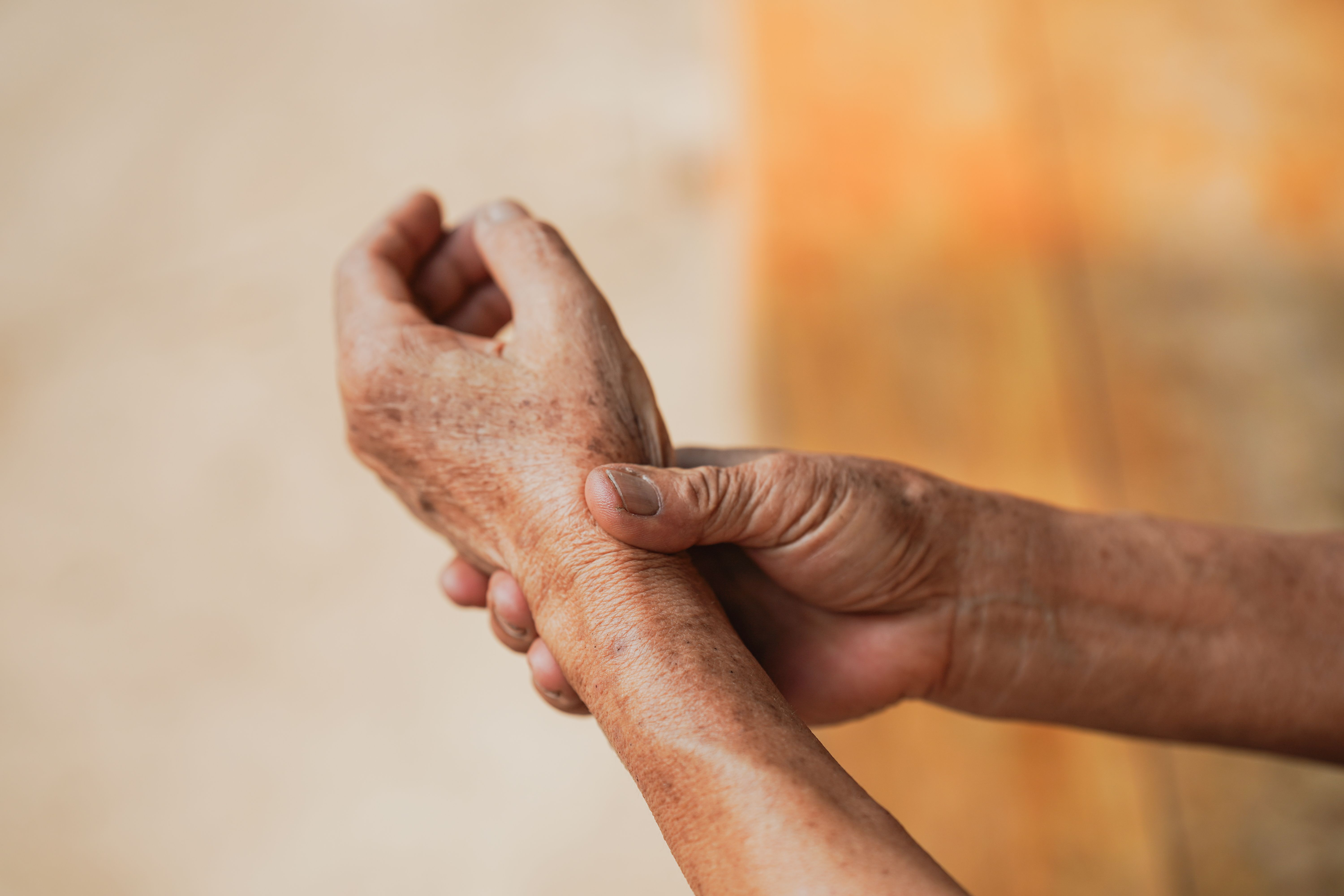 Psoriatic arthritis | Image credit: Oporty786 - stock.adobe.com