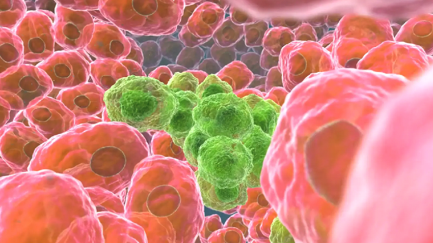 Gritstone Oncology